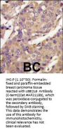 UBE2L6 Antibody (C-term)