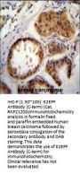 E2EPF Antibody (C-term)