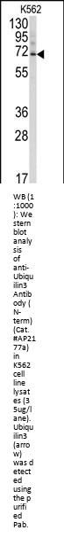 Ubiquilin3 Antibody (N-term)