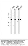 LECT1 Antibody (N-term)