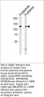 ENPP2 Antibody (Center)