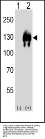 ENPP2 Antibody (Center)