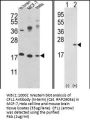 CFL1 Antibody (N-term)