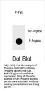 Phospho-IKKB(S672) Antibody