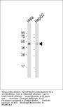 OPN1MW Antibody (N-term)