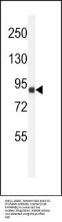ANR49 Antibody  (Center)