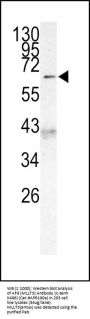 AF9 (MLLT3) Antibody (C-term K486)