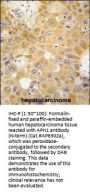 APH1 Antibody (N-term)