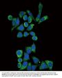 GLA Antibody (N-term)
