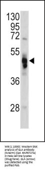 GLA Antibody (N-term)