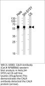 CALR Antibody