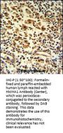 HMHA1 Antibody (Center)