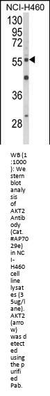 AKT2 Antibody