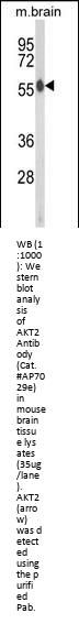 AKT2 Antibody