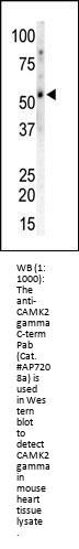 CAMK2G (CAMK2 gamma) Antibody (C-term)