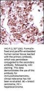 CAMK2G (CAMK2 gamma) Antibody (C-term)