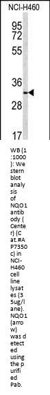 NQO1 Antibody (Center)