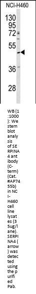 SERPINA4 Antibody (C-term)