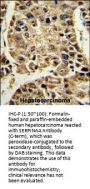 SERPINA4 Antibody (C-term)