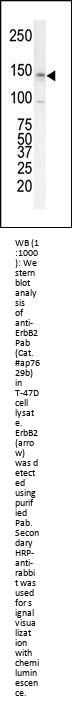 ErbB2 (C-term)