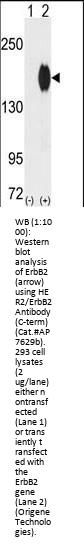 ErbB2 (C-term)