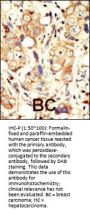 ErbB2 (C-term)