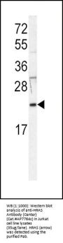 HRAS Antibody (Center)