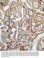 HRAS Antibody (Center)