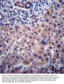CYP3A4 Antibody (Center)