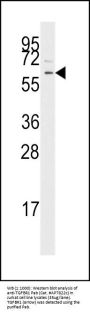 TGF Beta Receptor I Antibody (Center)
