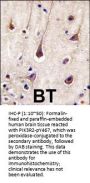 PIK3R2 Antibody (Y467)