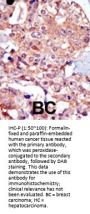 TRPM7 (CHAK1) Antibody (N-term)