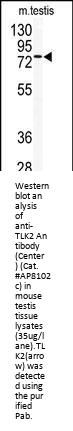 TLK2 Antibody (Center)