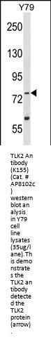 TLK2 Antibody (Center)