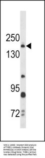 THBS1 Antibody (N-term)