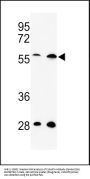 C13orf3 Antibody (Center)