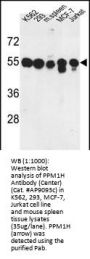 PPM1H Antibody (Center)
