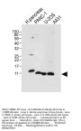 REG3A Antibody (N-term)