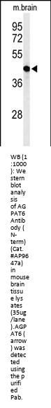 AGPAT6 Antibody (N-term)
