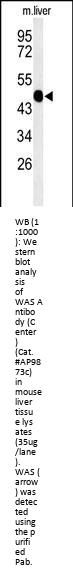 WAS Antibody (Center)