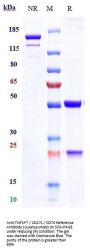 Anti-TNFSF7 / CD27L / CD70 Reference Antibody (cusatuzumab)