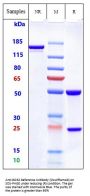 Anti-ROR2 Reference Antibody (Ozuriftamab)