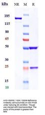 Anti-VEGFR2 / KDR / CD309 Reference Antibody (ramucirumab)