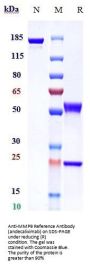 Anti-MMP9 Reference Antibody (andecaliximab)