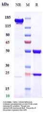 Anti-ERBB2 / HER2 / CD340 Reference Antibody (zanidatamab)