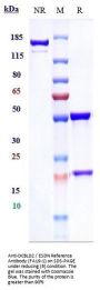 Anti-DCBLD2 / ESDN Reference Antibody (FA19-1)
