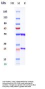 Anti-VEGFR2 / KDR / CD309 Reference Antibody (olinvacimab)