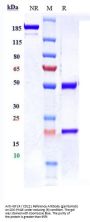 Anti-IGF1R / CD221 Reference Antibody (ganitumab)