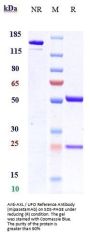 Anti-AXL / UFO Reference Antibody (mipasetamAb)