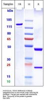 Anti-FOLH1 / PSMA Reference Antibody (pelgifatamAb)